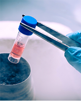 心肌细胞药物毒性检测服务
成人原代心肌细胞是研究心血管药物毒性最理想的细胞模型。在新药研究的过程中，成药的药物毒性为首要参考指标。对于心脏的药物毒性研究，由于缺乏优质的接近人体心肌细胞的细胞模型，多采用诱导多能干细胞...
