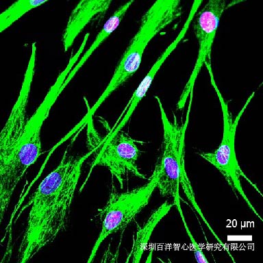 盘点人原代成纤维细胞分离培养遇到的问题