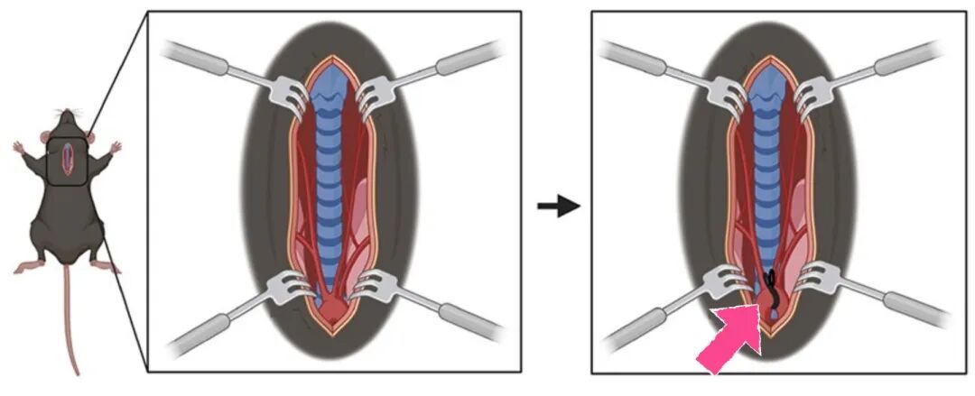 手把手教你做:小鼠心肌梗死(MI)模型和主动脉弓缩窄(TAC)致心肌肥厚模型实操要点