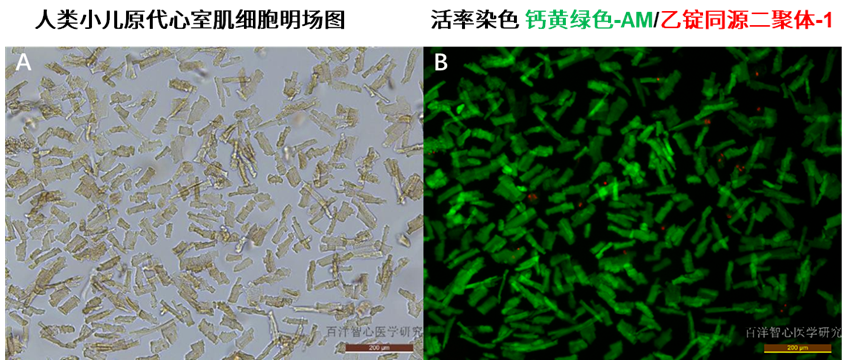 一步搞定人原代心肌细胞分离、培养、冻存!
