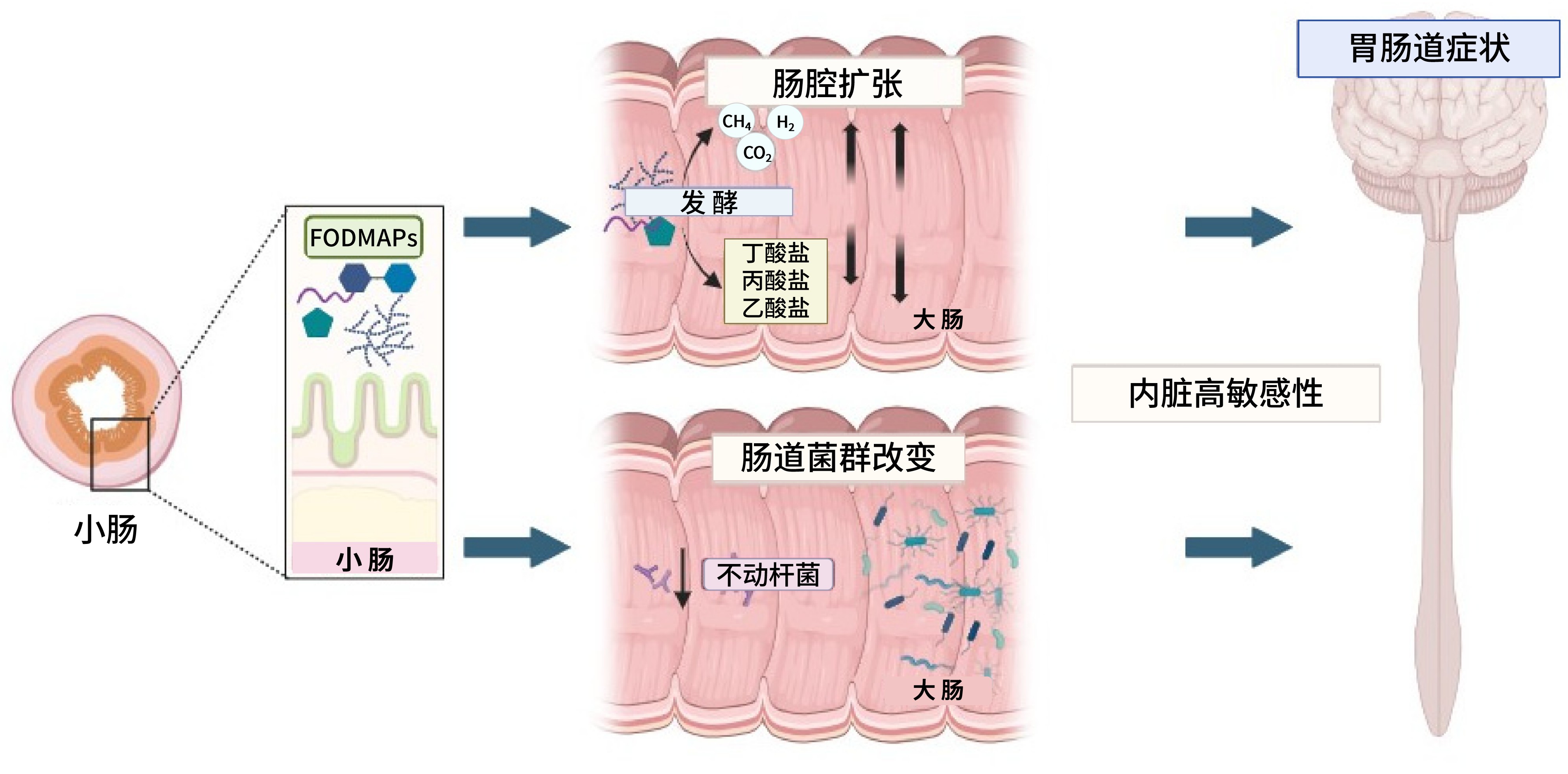 新-低fodmaps