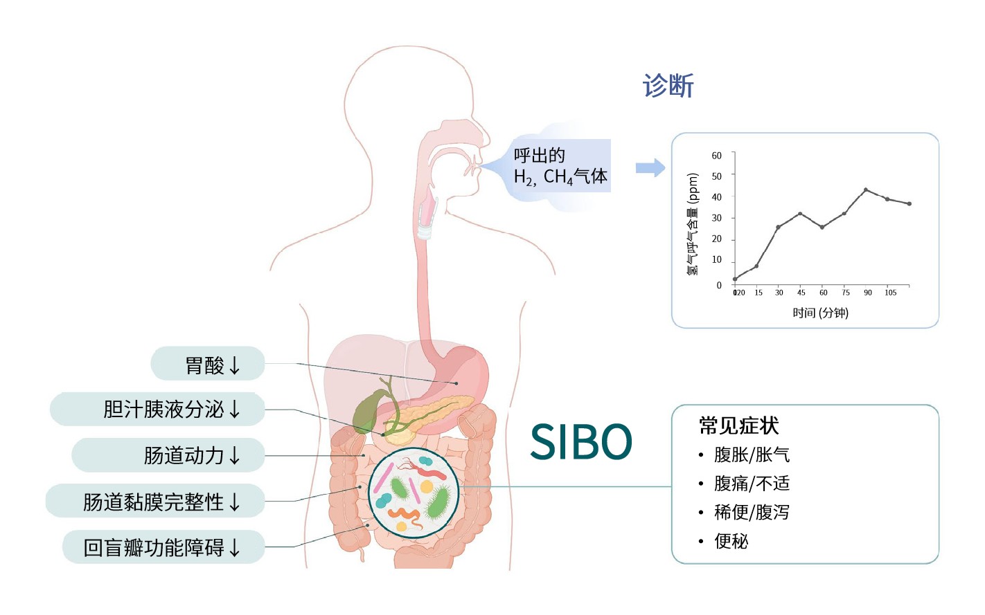 小肠细菌过度生长的诊断方法之甲烷和氢呼气试验