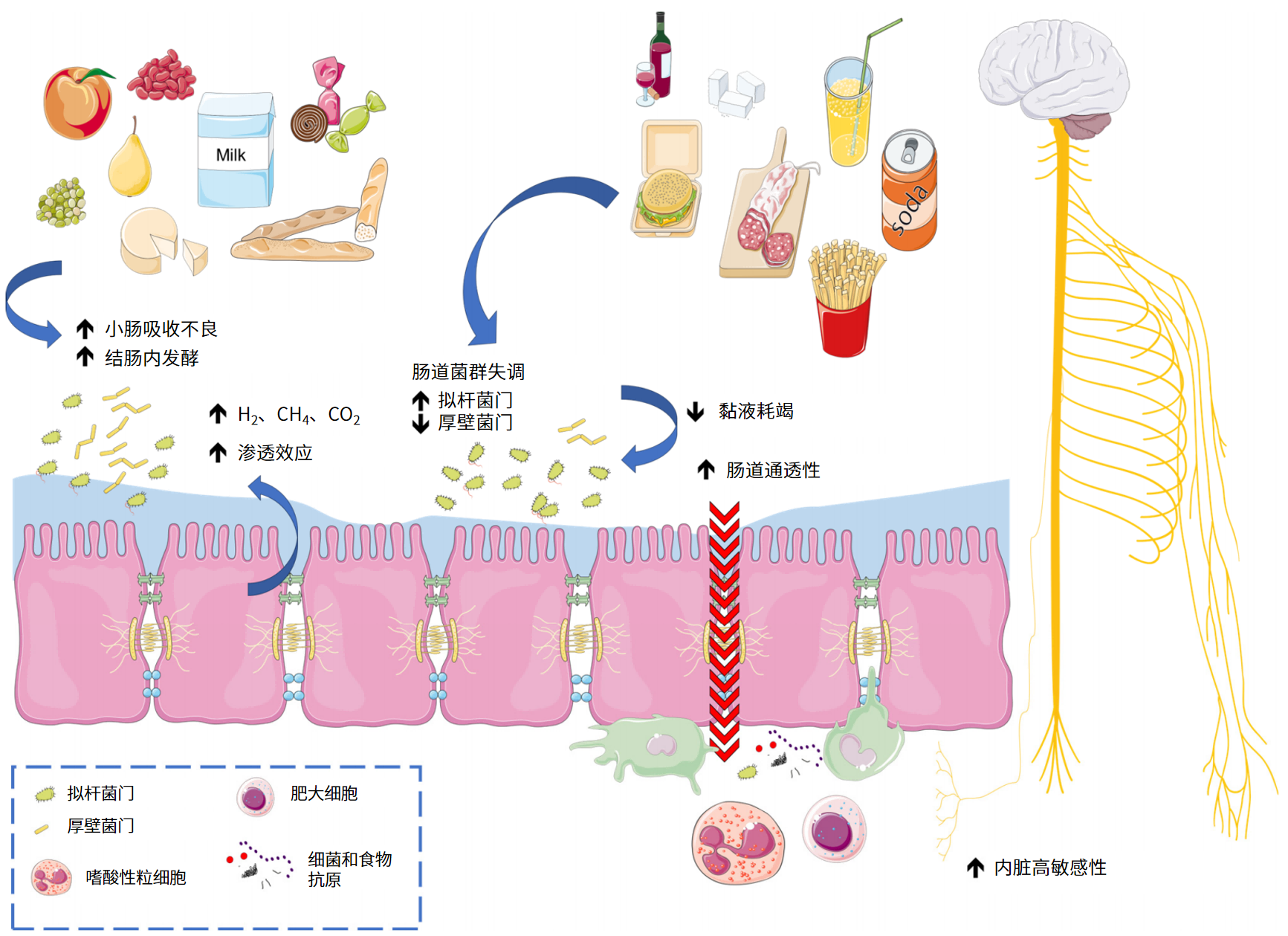 图片解读丨食物不耐受与肠易激综合征