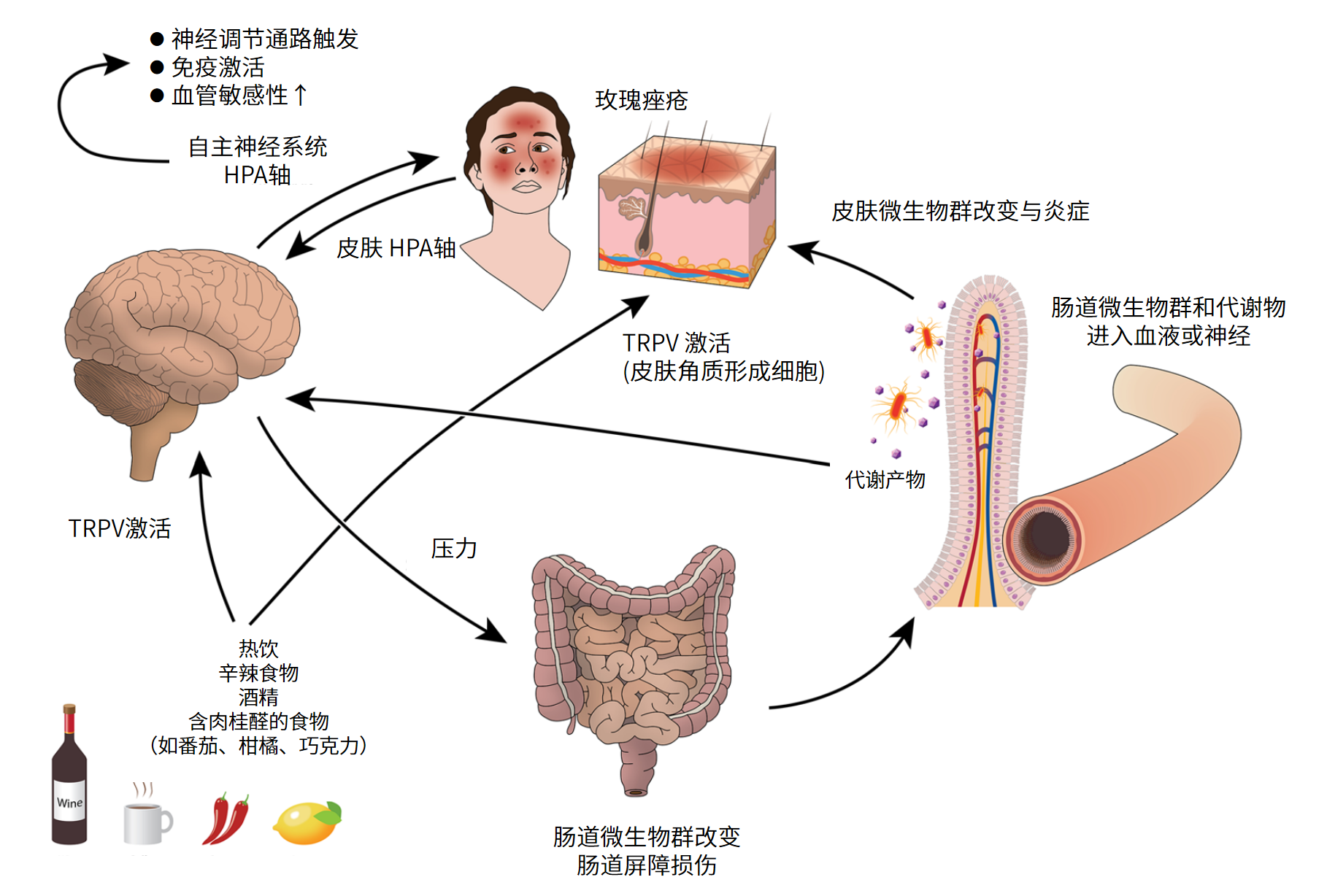 图片解读丨肠-脑-皮轴如何影响玫瑰痤疮