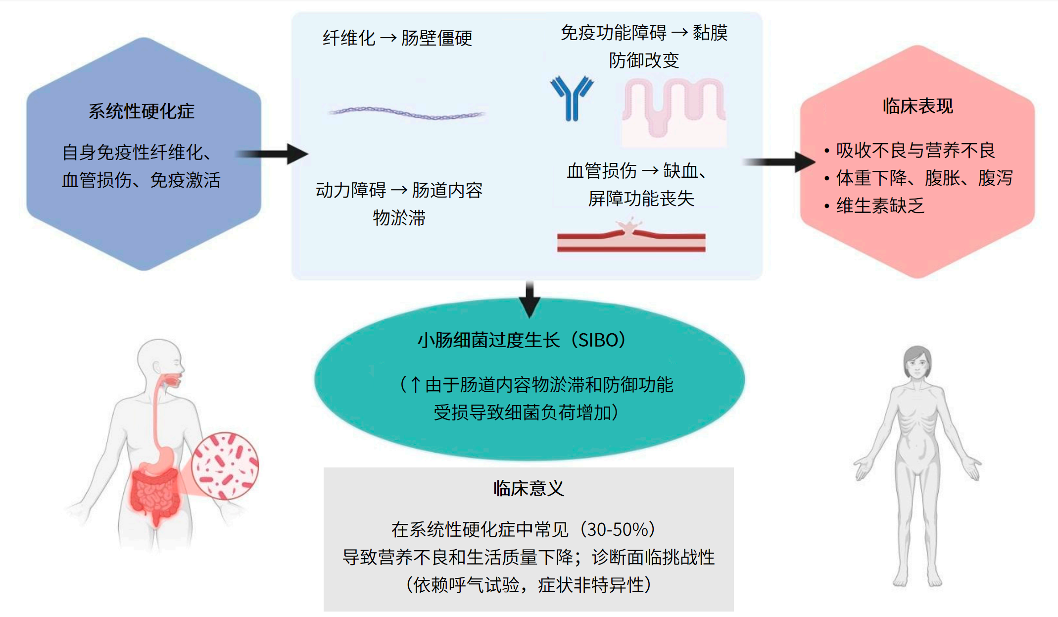 图片解读丨系统性硬化症与小肠细菌过度生长