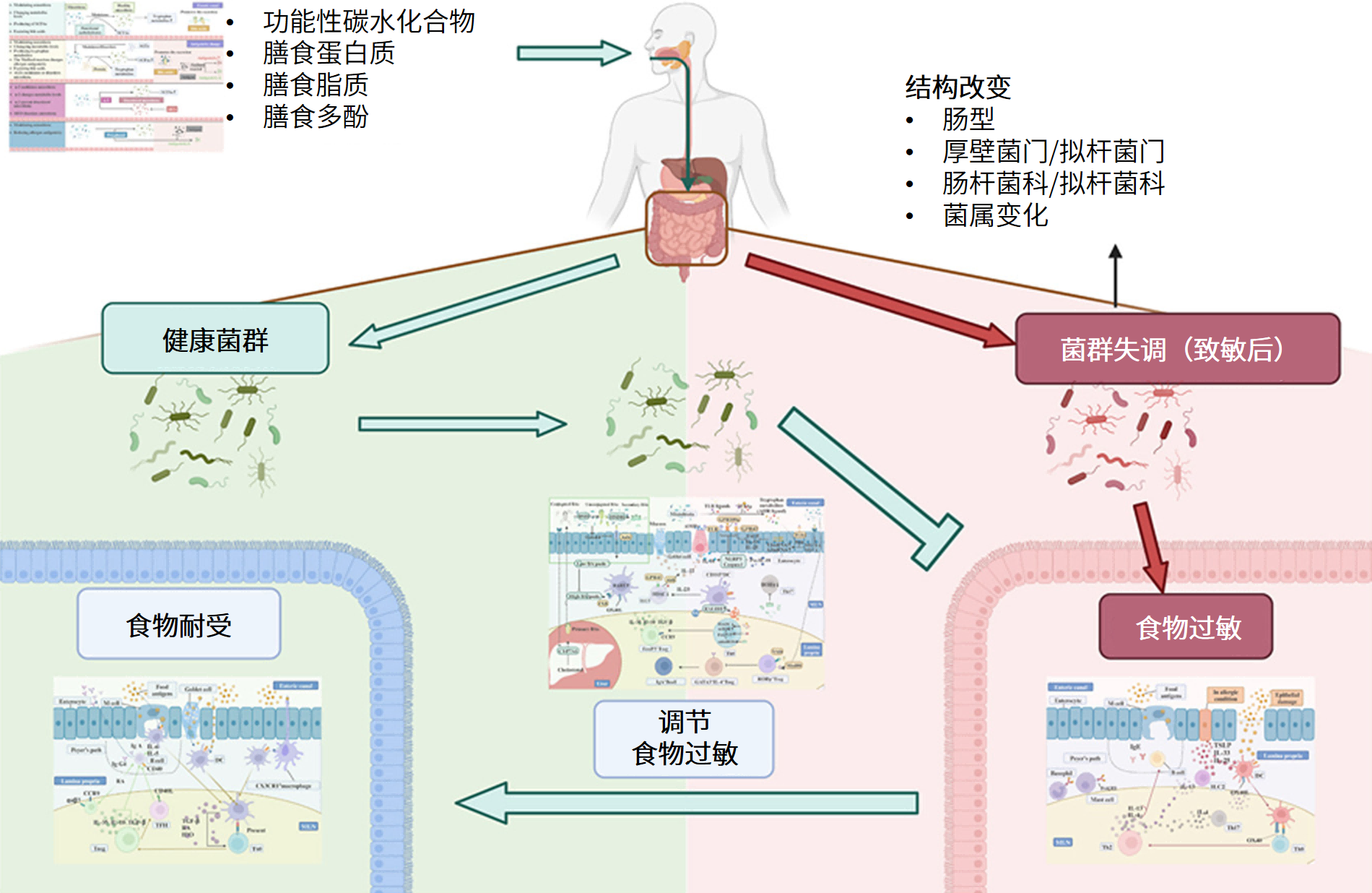 图片解读丨肠道菌群与食物过敏