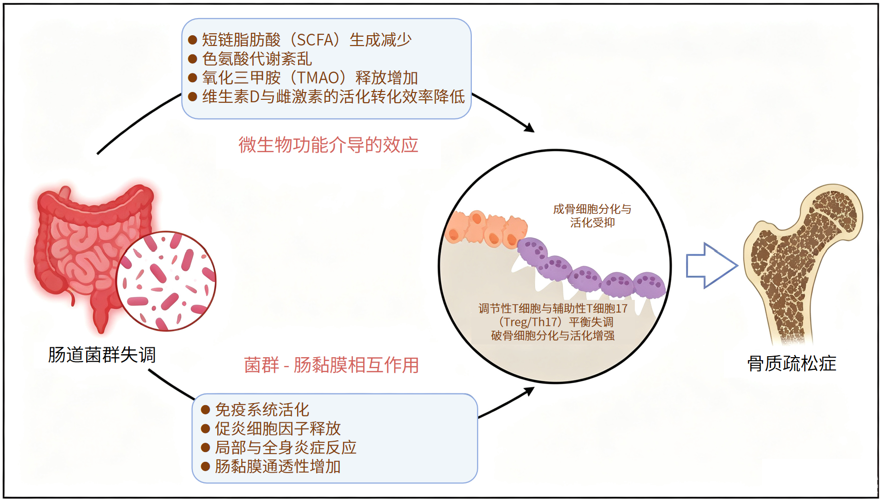图片解读丨肠道菌群失调对骨质疏松症的影响