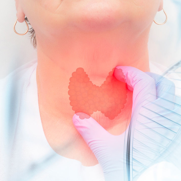 嘉早臻? —— 甲狀腺癌甲基化檢測