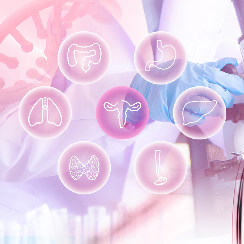 艾早臻?plus —— 七癌NGS甲基化檢測