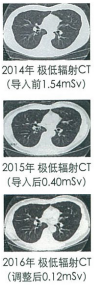 特色3 极低辐射量的CT检查
(肺部 ·腹部CT检查)
本院投入使用2台新开发的辐射量极低的CT机,不使用X光,而一律使用螺旋CT进行肺癌检查。辐射量可降低至与普通的X光检查相近的水准。CT机搭配最高水平的CT图像构成技术(VeoTM,GE公司),可通过精确细微地调整摄影条件,降低辐射量,提供高画质及正确的信息供医师诊断。