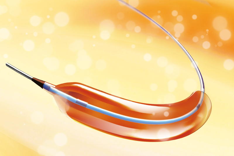 NC Rockstar™ Non Compliant PTCA Balloon Dilatation Catheter