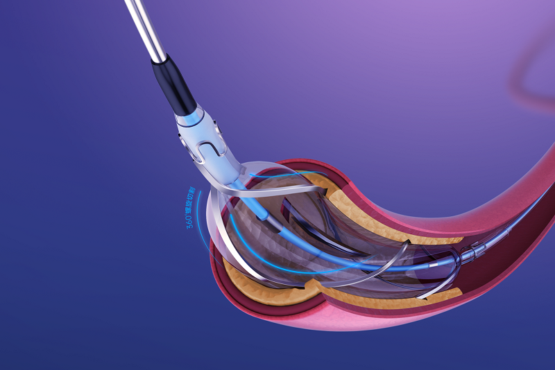 Tradent™ Coronary Scoring Balloon Catheter