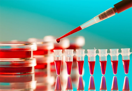 Laboratory Consumables