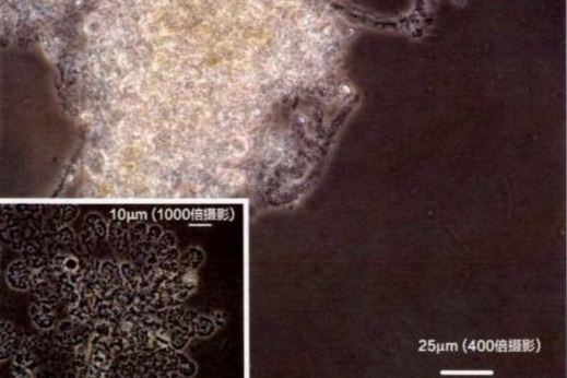 澳德龙技术手册:活性污泥微生物镜检|附35种微生物图谱和10个问答