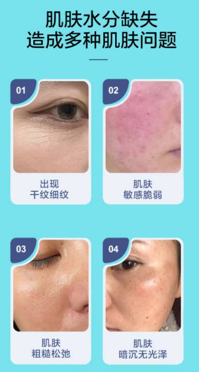祛斑后的 “干敏危肌”，你中招了嗎？