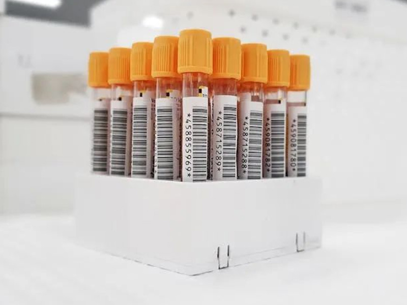 CRP、、PCT、、、、SAA、、、IL-6