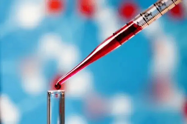 IVD 原料明星 ——SAA：为精准诊断助力