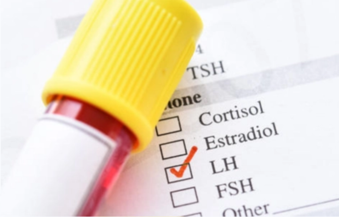 原料精品 | 促黄体生成素(LH抗体)