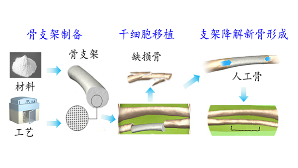 医用骨植入物的个性化3D打印技术与装备