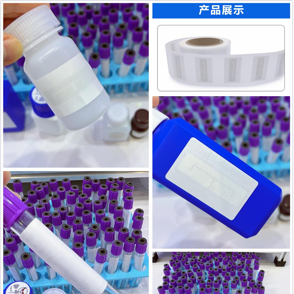 RZX Technology's Brief Analysis | Management and Application of Tubular Injection Tags on Animals