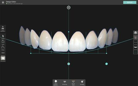 Digital Smile Design: we digitally recreate the smile of your dreams
