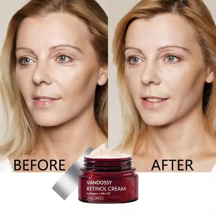 كريم التجاعيد