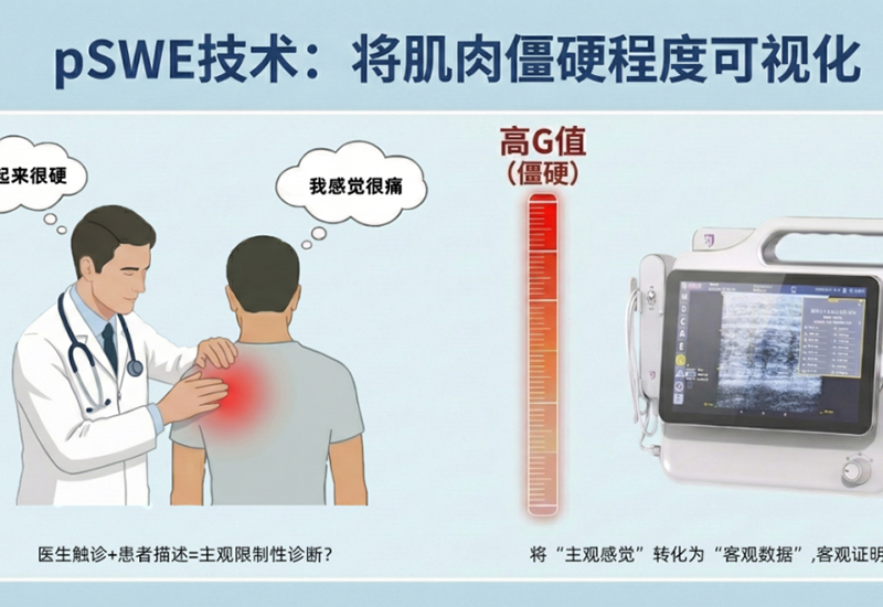 科研速递  曦健科技软组织力学定量技术：赋能肌筋膜疼痛综合症精准诊疗