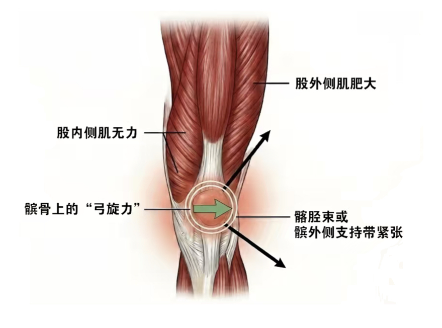 膝前痛原理