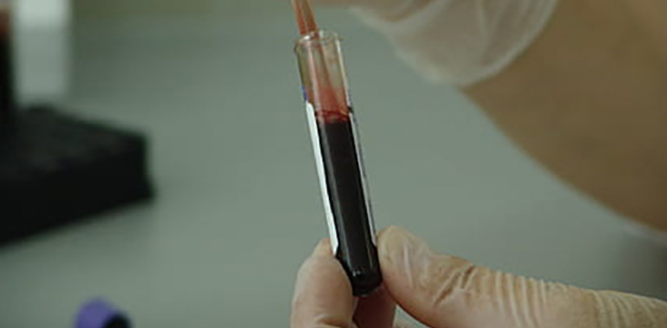 WB转膜可以不用甲醇激活吗？