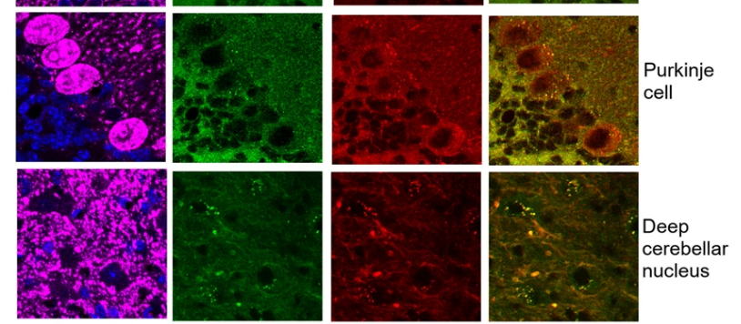 为什么一些荧光图是粉紫色？用的是什么荧光二抗啊？