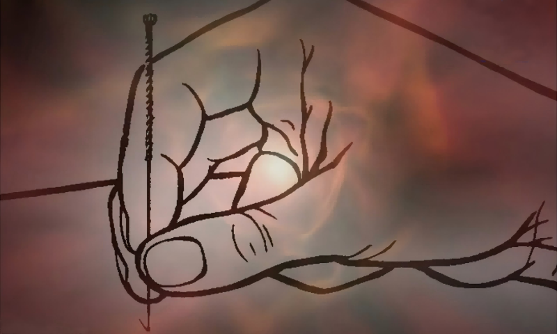 中医在美国：西医看不好的，都来看中医了