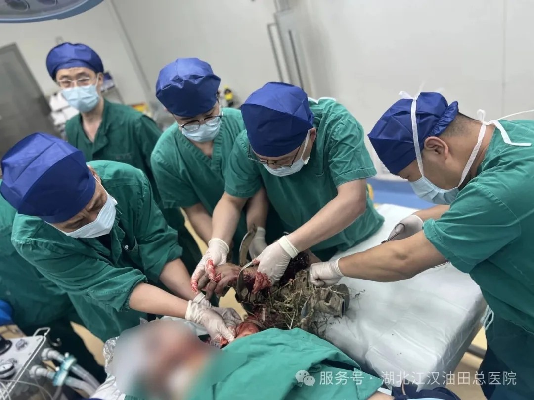 我院多学科团队协作成功救治旋耕机绞伤患者