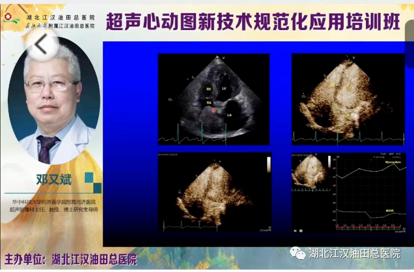 省专家教授解读超声心动图新技术新规范