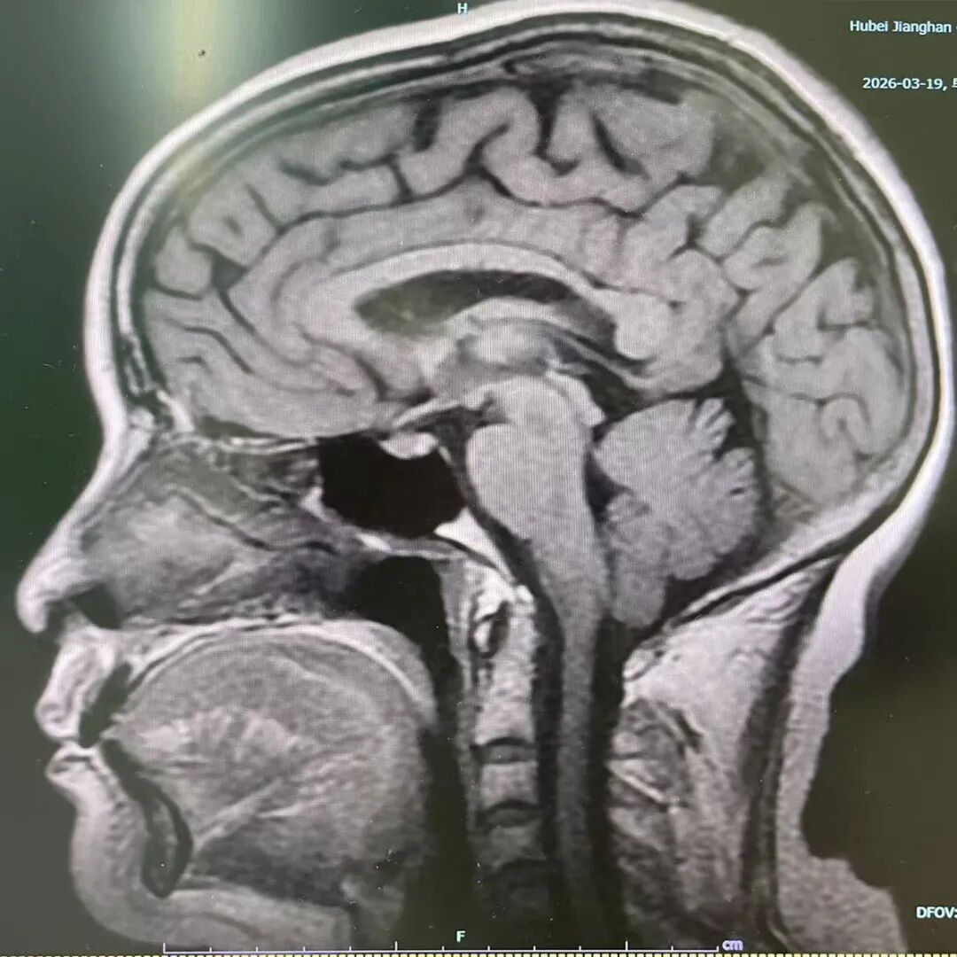 磁共振影像.jpg