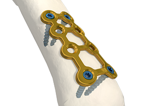 1.5 structural plate