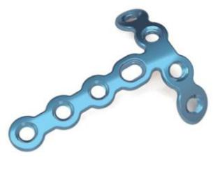 1.5mm Locking T Plate - III