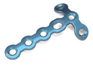 1.5mm Locking T Plate - II