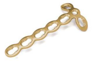 2.0mm Locking T Plate - III