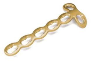 2.0mm Locking T Plate - II