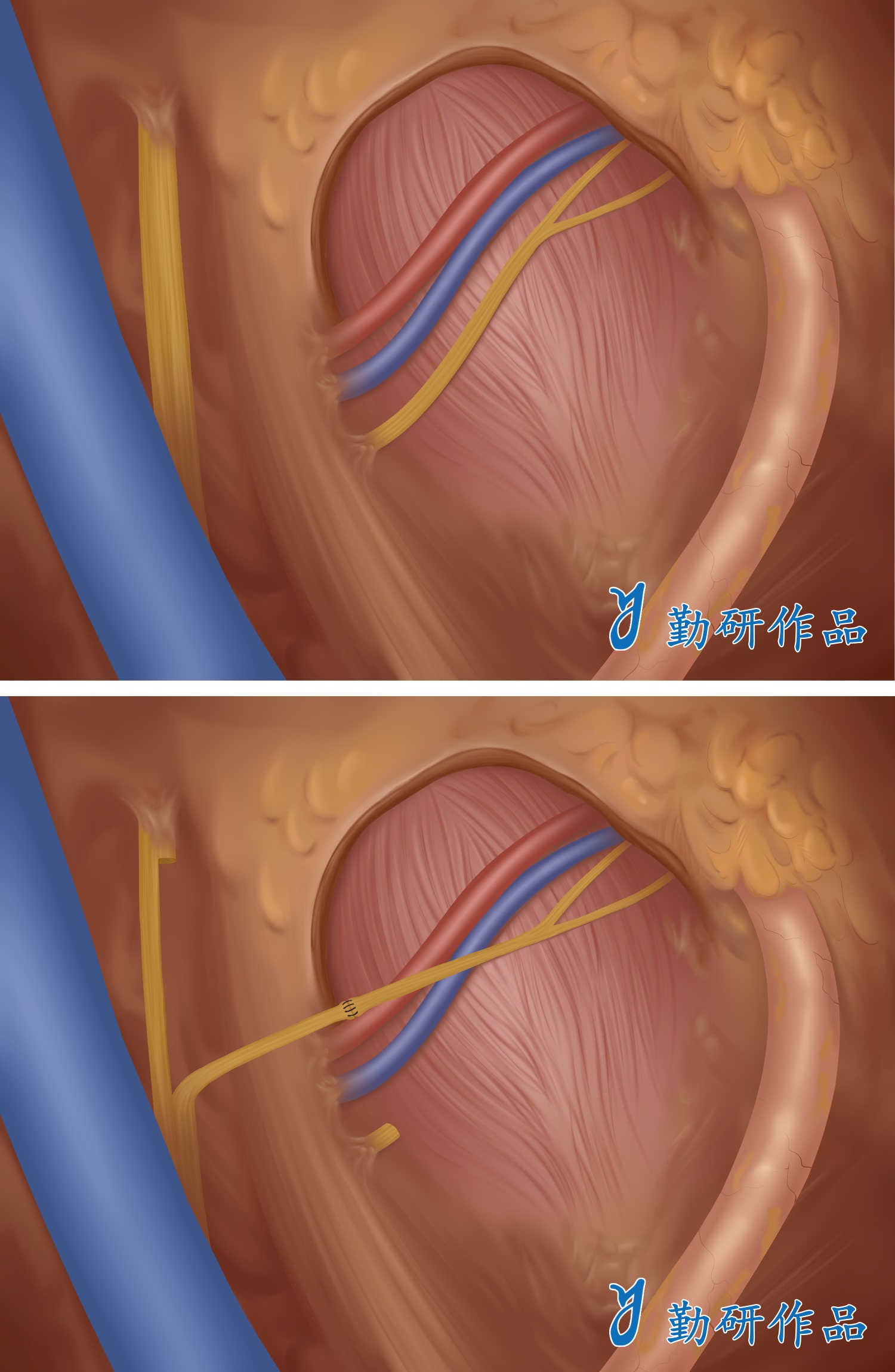 International Urology and Nephrology